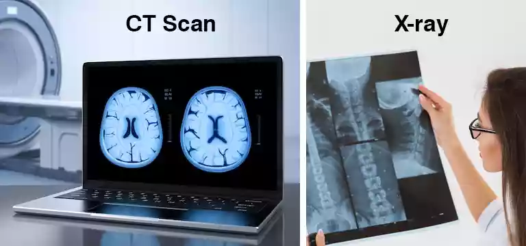 CT Scan vs. X-ray: A Comparative Analysis - Which Imaging Technique is Right for You